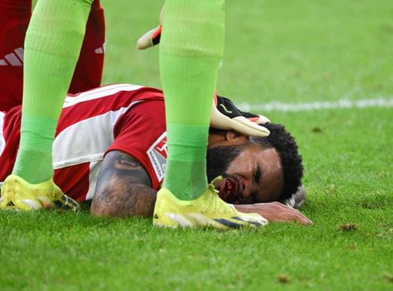 Verletzung Jamil Siebert (Fortuna Duesseldorf) 03.05.2024, Fussball 2. Bundesliga, 32. Spieltag, Saison 2023 2024 Fortuna Düsseldorf - 1. FC Nürnberg 3:1 Düsseldorf Nordrhein Westfalen Deutschland