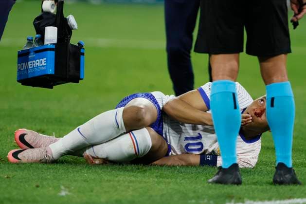 Austria v France: Group D - UEFA EURO, EM, Europameisterschaft,Fussball 2024 Kylian Mbappe of France after injury during the UEFA EURO 2024 group stage match between Austria and France at Düsseldorf Arena on June 17, 2024 in Dusseldorf, Germany. Düsseldorf Düsseldorf Arena Germany Germany Copyright: xRichardxSellers Sportsphoto APLx 14041149