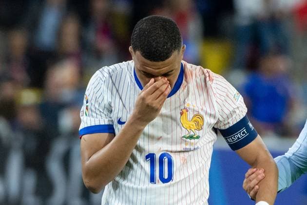 Kylian Mbappe (Frankreich, 10) ist verletzt und wird behandelt, GER, Austria (AUT) vs France (FRA), Fussball Europameisterschaft, UEFA EURO, EM, Europameisterschaft,Fussball 2024, Gruppe D, 1. Spieltag, 17.06.2024 GER, Austria (AUT) vs France (FRA), Fussball Europameisterschaft, UEFA EURO 2024, Gruppe D, 1. Spieltag, 17.06.2024 Duesseldorf Copyright: xEibner-Pressefoto Memmlerx EP_MMR