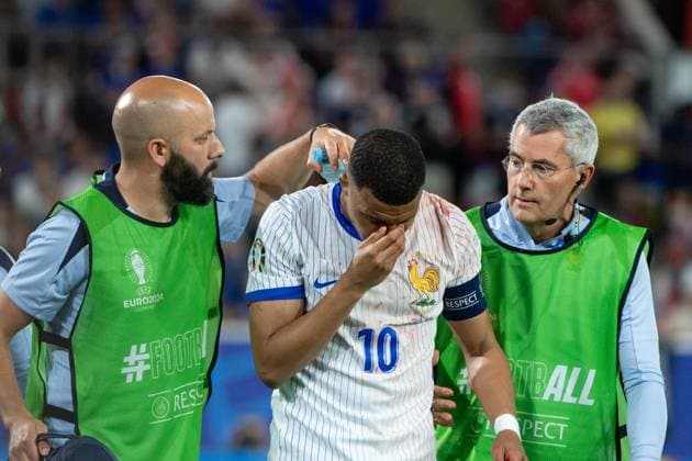 Kylian Mbappe (Frankreich, 10) ist verletzt und wird behandelt, GER, Austria (AUT) vs France (FRA), Fussball Europameisterschaft, UEFA EURO, EM, Europameisterschaft,Fussball 2024, Gruppe D, 1. Spieltag, 17.06.2024 GER, Austria (AUT) vs France (FRA), Fussball Europameisterschaft, UEFA EURO 2024, Gruppe D, 1. Spieltag, 17.06.2024 Duesseldorf Copyright: xEibner-Pressefoto Memmlerx EP_MMR