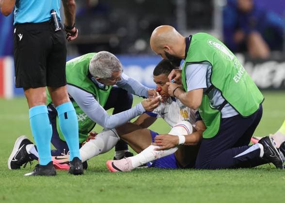 Dusseldorf, Germany, 17th June 2024. Kylan Mbappe of France goes down injured with a broken nose during the UEFA European Championships match at Dusseldorf Arena, Dusseldorf. Picture credit should read: David Klein Sportimage EDITORIAL USE ONLY. No use with unauthorised audio, video, data, fixture lists, club league logos or live services. Online in-match use limited to 120 images, no video emulation. No use in betting, games or single club league player publications. SPI-3197-0095