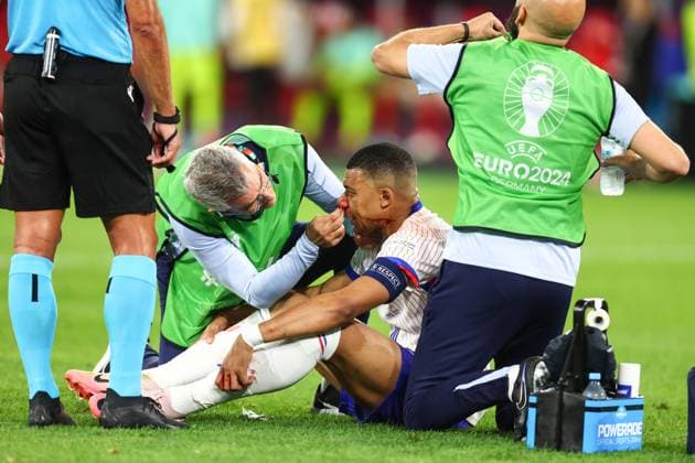 Austria v France 17 June 2024, Dusseldorf - UEFA EUROs - Group D - Austria v France - Kylian Mbappe of France receives treatment from medical personnel for a nose bleed - Photo: Charlotte Wilson Offside. Dusseldorf Germany Copyright: xCharlottexWilsonx xOffsidexOffside
