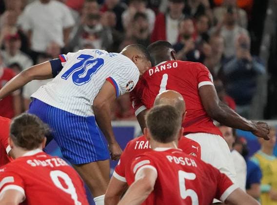 17.06.2024, Düsseldorf Arena, Düsseldorf, GER, EM UEFA 2024, Group D, Austria vs France, im Bild Kylian MbappÃ (France) verletzt sich bei einem Zweikampf und muss mit blutender Nase ausgewechselt werden. Defodi-506_20240617_hbr_3759