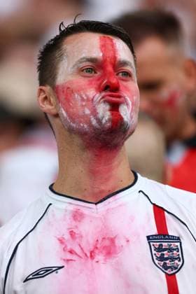 Netherlands v England 10 July 2024, Dortmund - UEFA EUROs - Semi-Final - Netherlands v England - An England fan with face paint that has run down onto his shirt - Photo: Charlotte Wilson Offside. Dortmund Germany Copyright: xCharlottexWilsonx xOffsidexOffside