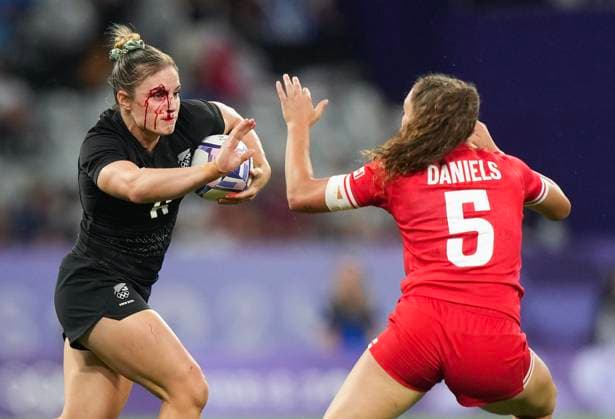 July 28, 2024, Paris, FRANCE: New Zealand back Michaela Blyde (6) runs with the ball with a bloodied face against Canada back Chloe Daniels (5) during second half women s rugby 7s action at the 2024 Summer Olympics in Paris, France on Sunday, July 28, 2024. Canada News - July 28, 2024  - ZUMAc35_ 20240728_zaf_c35_142 Copyright: xNathanxDenettex