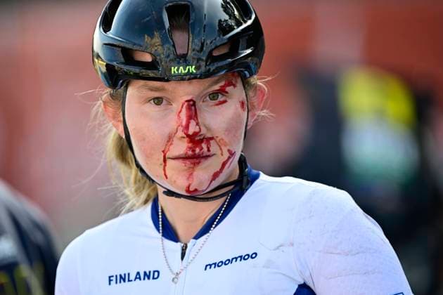 Bilder des Jahres 2024, Sport 09 September Sport Themen der Woche KW37 Sport Bilder des Tages Finnish Turpeinen Viivi pictured with an injury after the Women s Junior Road Race at the European Championship, EM, Europameisterschaft 2024, in Hasselt, Sunday 15 September 2024. The UEC Road European Championships 2024 will take place from 11 to 15 september in Limburg, Belgium. DIRKxWAEM  x100679296x