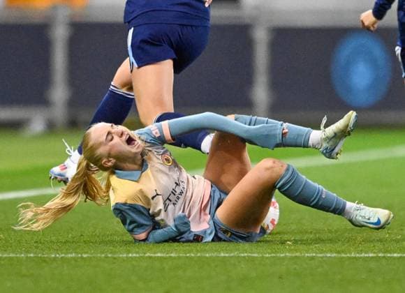 Manchester City Women v Paris FC Women UEFA Womens Champions League Laura Blindkillde Brown of Manchester City women is fouled during the UEFA Womens Champions League match at Joie Stadium, Manchester UK Newspapers OUT Copyright: xKarlxVallantinex FIL-20669-0035