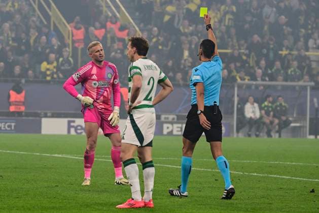 Gelbe Karte Kasper Schmeichel 1 (Celtic Glasgow), Borussia Dortmund vs. Celtic Glasgow, Fussball, Champions League, 2. Spieltag, 01.10.2024 Dortmund Nordrhein-Westfalen Deutschland