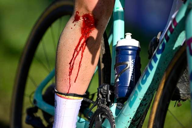 2024 UEC Cyclo-Cross EC - Women U23 PONTEVEDRA, SPAIN - NOVEMBER 03 : injury of Coppens Nette (BEL) during the 2024 UEC Cyclo-Cross European Championships for Women U23 on November 03, 2024 in Pontevedra, Spain, 03 11 2024 Pontevedra Spain  Copyright: xNicoxVereeckenx