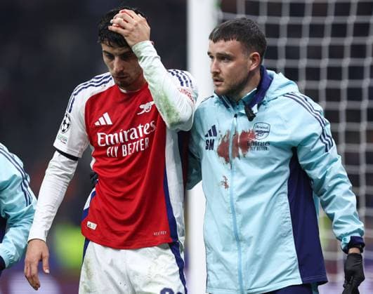 Bilder des Jahres 2024, Sport 11 November Sport Themen der Woche KW45 Sport Bilder des Tages Kai Havertz of Arsenal sustains a bloody head injury Inter Milan v Arsenal, UEFA Champions League, Group Stage, Football, San Siro Stadium, Milan, Italy - 06 Nov 2024 EDITORIAL USE ONLY No use with unauthorised audio, video, data, fixture lists, club league logos or live services. Online in-match use limited to 120 images, no video emulation. No use in betting, games or single club league player publications.  Copyright: xMarcoxCanienero Shutterstockx 14863816bj