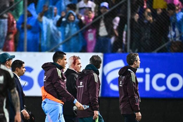 Fußball, CONCACAF Nations League, Mexikos Trainer Javier Aguirre durch Wurfgeschoss verletzt RECORD DATE NOT STATED IV CONCACAF NATIONS LEAGUE 2024-2025 Honduras vs Mexico Javier Aguirre head coach of Mexico has blood on his head due to an attack by Honduras fans during the Quarterfinals first leg match between Honduras and Mexican national team, Nationalteam (Mexico) as part of the Concacaf Nations League 2024-2025 at Francisco Morazan Stadium on November 15, 2024 in San Pedro Sula, Honduras. SAN PEDRO SULA HONDURAS HONDURAS  Copyright: xAdrianxMaciasx 20241115221844_CNL_CFI_HON_MEX_AGUIRRE182