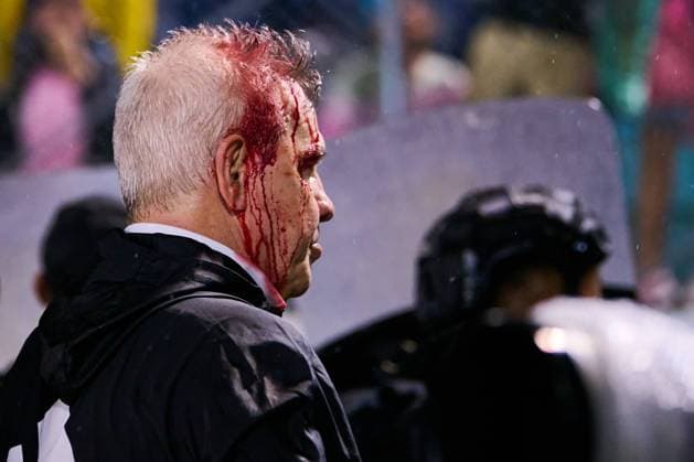 Bilder des Jahres 2024, Sport 11 November Sport Themen der Woche KW46 Fußball, CONCACAF Nations League, Mexikos Trainer Javier Aguirre durch Wurfgeschoss verletzt RECORD DATE NOT STATED IV CONCACAF NATIONS LEAGUE 2024-2025 Honduras 2-0 Mexico Javier Aguirre head coach of Mexico has blood on his head due to an attack by Honduras fans during the Quarterfinals first leg match between Honduras and Mexican national team, Nationalteam (Mexico) as part of the Concacaf Nations League 2024-2025 at Francisco Morazan Stadium on November 15, 2024 in San Pedro Sula, Honduras. SAN PEDRO SULA HONDURAS HONDURAS  Copyright: xJosexLuisxMelgarejox 20241115231149_CNL_CFI_HON_MEX_AGUIRRE241