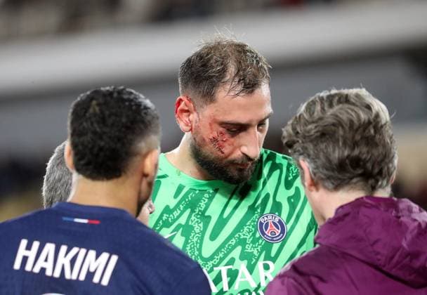 Bilder des Jahres 2024, Sport 12 Dezember Sport Themen der Woche KW51 Sport Bilder des Tages FOOT MONACO-PSG PHOTOPQR NICE MATIN Jean François Ottonello ; Monaco ; 18 12 2024 ; AS MONACO vs PARIS SAINT GERMAIN - 16e journee de championnat de France 2024 2025 - Donnarumma blessé 18th December 2024; MONACO AS MONACO vs PARIS SAINT GERMAIN - 16th day of the French championship 2024 2025 Paris player Donnaruma injury after having been hit by Singo during match Monaco France  Copyright: xPHOTOPQR NICExMATIN MAXPPPxJeanxFrançoisxOttonellox 20241218NIM5272 20241218NIM5272