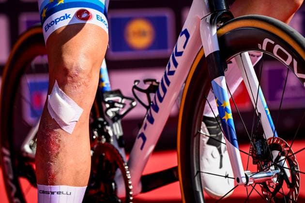 The knee of Belgian Tim Merlier of Soudal Quick-Step pictured at the start of the men elite race of the Dwars Door Vlaanderen cycling event, 184,2km from Roeselare to Waregem, Wednesday 02 April 2025. DIRKxWAEM  x118228911x