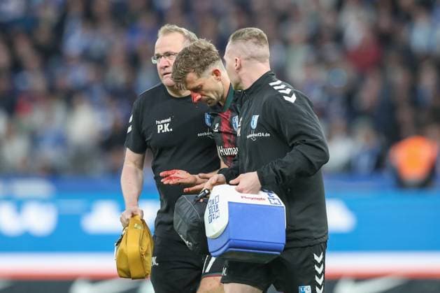 25.04.2025, xtgx, Fussball - 2.Bundesliga, Hertha BSC Berlin - 1.FC Magdeburg emspor, v.l. Alexander Nollenberger (Magdeburg, 17 ) ist an der Nase verletzt, Verletzung (DFL DFB REGULATIONS PROHIBIT ANY USE OF PHOTOGRAPHS as IMAGE SEQUENCES and or QUASI-VIDEO) Berlin