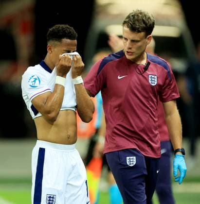 Omari Hutchinson of England covers his face. Spain U21, U 21 v England U21, UEFA U21 Championship, Quarter-final, Stadion Antona Malatinskeho, Slovakia - 21 Jun 2025  Copyright: xNikolaxKrstic Shutterstockx 15367881cg
