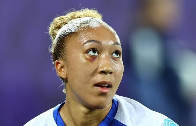 Sport Bilder des Tages Lauren James of England Women with a bruised eye from a challenge in the France match England Women v Wales Women, UEFA European Women s Championship, Football, Arena St. Gallen, St. Gallen, Switzerland - 13 Jul 2025St. Gallen Arena St. Gallen Switzerland EDITORIAL USE ONLY No use with unauthorised audio, video, data, fixture lists, club league logos or live services. Online in-match use limited to 120 images, no video emulation. No use in betting, games or single club league player publications.  Copyright: xMichaelxZemanek Shutterstockx 15395663bm