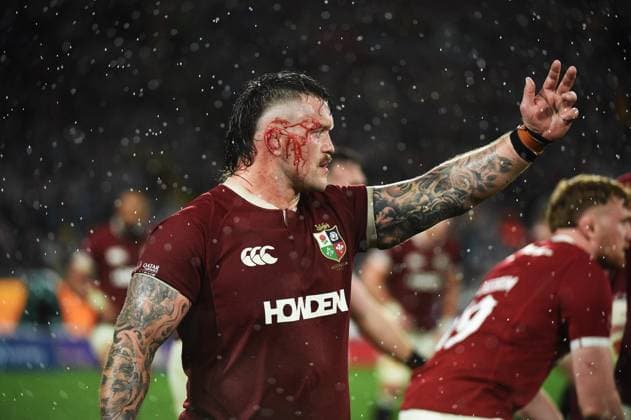 Andrew Porter - British & Irish Lions prop with a cut ear. Australia v British and Irish Lions, Third Test, Accor Stadium, Sydney, Australia - 02 Aug 2025Sydney Accor Stadium New South Wales (NSW) Australia  Copyright: xGibson Fotosport Shutterstockx 15424559p
