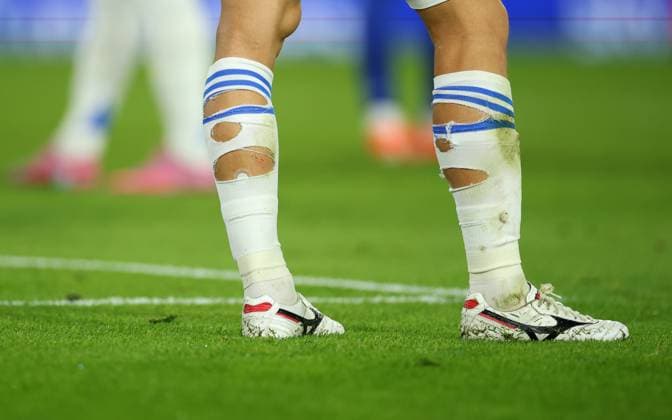 Leeds United v Everton Premier League 18 08 2025. The ripped socks of Ao Tanaka of Leeds United during the Premier League match between Leeds United and Everton at Elland Road, Leeds, England on 18 August 2025. Leeds Elland Road West Yorkshire England Editorial use only DataCo restrictions apply See www.football-dataco.com , Copyright: xRyanxBrownex PSI-22616-0065