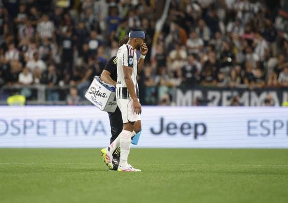 CALCIO - Serie A - Juventus FC vs Parma Calcio Gelson Bremer of Juventus FC during the Italian Serie A 2025 26 season, football match between Juventus FC and Parma Calcio 1913 on 24 August 2025 at Allianz Stadium in Turin, Italy. Photo Nderim Kaceli Turin Italy  Copyright: xIPAxSport ABACAx