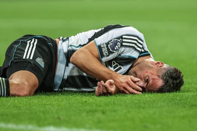 Premier League Newcastle United v Liverpool Fabian Schär of Newcastle United on the floor with a head injury during the Premier League match Newcastle United vs Liverpool at St. James s Park, Newcastle, United Kingdom, 25th August 2025 (Photo by Mark Cosgrove News Images) Newcastle St. James s Park Tyne and Wear United Kingdom Copyright: xMarkxCosgrove NewsxImagesx