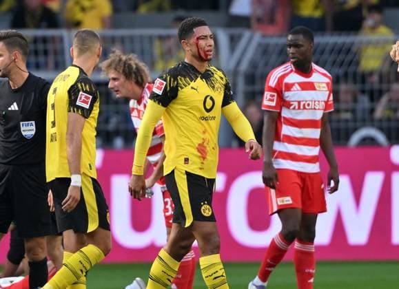 Jobe Bellingham (Borussia Dortmund) mit einer Platzwunde 31.08.2025, Fussball 1. Bundesliga, Saison 2025 2026, 2. Spieltag, Borussia Dortmund - Union Berlin DFL regulations prohibit any use of photographs as image sequences and or quasi-video Dortmund Signal Iduna Park Nordrhein Westfalen Deutschland *** Jobe Bellingham Borussia Dortmund with a laceration 31 08 2025, Football 1 Bundesliga, Season 2025 2026, 2 Matchday, Borussia Dortmund Union Berlin DFL regulations prohibit any use of photographs as image sequences and or quasi video Dortmund Signal Iduna Park Nordrhein Westfalen Germany Team2