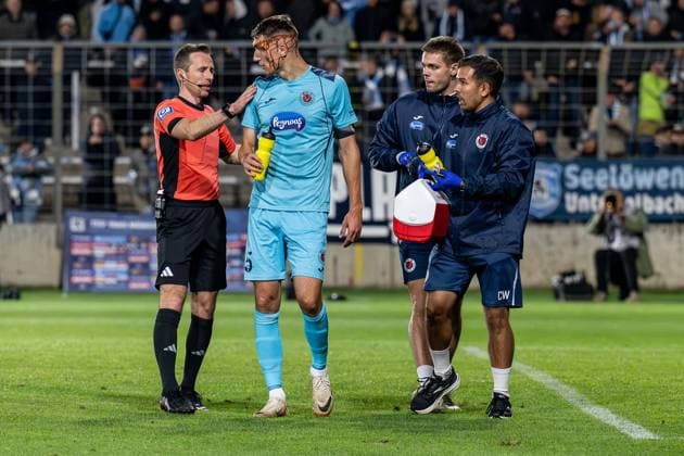 Lukas Benen (Schiedsrichter) und die Betreuer kuemmern sich umChristoph Greger (FC Viktoria Koeln, 15), der nach einem Zusammenstoss mit Eduardo Dos Santos Haesler - Dudu (Torwart, FC Viktoria Koeln, 1) - nicht im Bild - stark blutet GER, TSV 1860 Muenchen vs. Viktoria Koeln 1904, Fussball, 3. Bundesliga, 9. Spieltag, Saison 2025 2026, 01.10.2025. (DFL DFB REGULATIONS PROHIBIT ANY USE OF PHOTOGRAPHS as IMAGE SEQUENCES and or QUASI-VIDEO). GER, TSV 1860 Muenchen vs. Viktoria Koeln 1904, Fussball, 3. Bundesliga, 9. Spieltag, Saison 2025 2026, 01.10.2025. Muenchen Copyright: xEibner-Pressefoto HeikexFeinerx EP_HFR