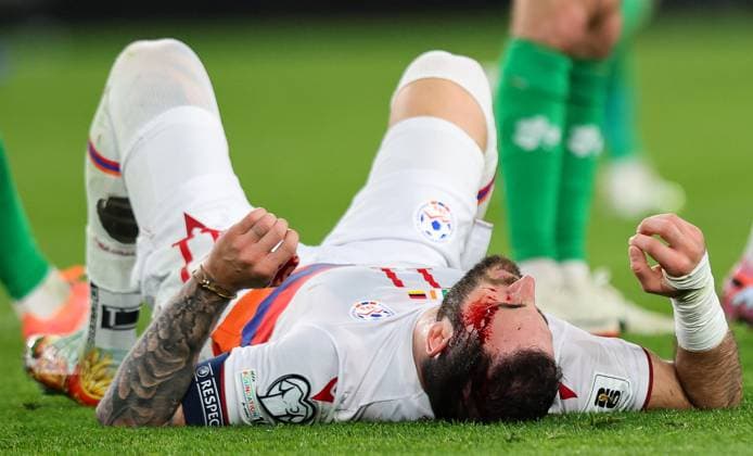 2026 FIFA World Cup, WM, Weltmeisterschaft, Fussball Qualifier Group F, Aviva Stadium Dublin 14 10 2025 Republic of Ireland vs Armenia Armenias Tigran Barseghyan down injured igran Barseghyan down injured 14 10 2025  Copyright: x INPHO RyanxByrnex RB1_9003