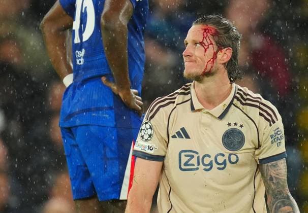 Wout Weghorst of Ajax after an accidental boot in the face from Tosin Adarabioyo of Chelsea Chelsea v Ajax, UEFA Champions League, Group Stage, Football, Stamford Bridge, London, UK - 22 Oct 2025London Stamford Bridge United Kingdom EDITORIAL USE ONLY No use with unauthorised audio, video, data, fixture lists, club league logos or live services. Online in-match use limited to 120 images, no video emulation. No use in betting, games or single club league player publications.  Copyright: xJavierxGarcia Shutterstockx 15558807s