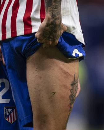 MADRID, SPAIN - OCTOBER 18: Julián Alvarez of Atletico Madrid (detail of marks on leg) during the LaLiga EA Sports match between Atletico Madrid v Sevilla at the Estadio Civitas Metropolitano on November 1, 2025 in Madrid Spain (Photo by Ricardo Nogueira Sports Press Photo) Copyright: xRicardoxNogueirax Sportspressphoto_SPR54975