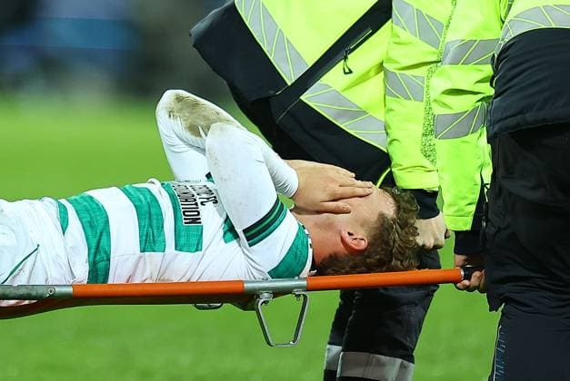 Callum Osmand of Celtic looks injured and is taken off the pitch Midtjylland vs Celtic, UEFA Europa League, Group Stage, Football, MCH Arena, Herning, Denmark - 06 Nov 2025Herning MCH Arena Denmark EDITORIAL USE ONLY No use with unauthorised audio, video, data, fixture lists, club league logos or live services. Online in-match use limited to 120 images, no video emulation. No use in betting, games or single club league player publications. Copyright: xMichaelxZemanek Shutterstockx 15642247aq