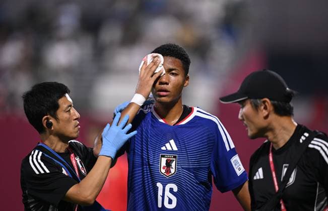 Fussball, Junioren U 17 WM 2025 Doha Katar Sechzehntelfinal 15.11.2025 Spiel 82 Japan - Suedafrika Simon Yu Mendy (Japan) muss mit einer Platzwunde am Kopf ausgewechselt werden.
