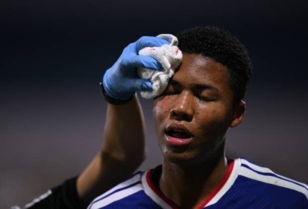 Fussball, Junioren U 17 WM 2025 Doha Katar Sechzehntelfinal 15.11.2025 Spiel 82 Japan - Suedafrika Simon Yu Mendy (Japan) muss mit einer Platzwunde am Kopf ausgewechselt werden.