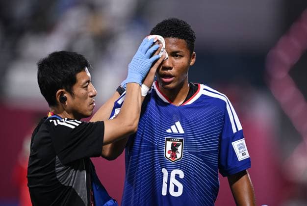 Fussball, Junioren U 17 WM 2025 Doha Katar Sechzehntelfinal 15.11.2025 Spiel 82 Japan - Suedafrika Simon Yu Mendy (Japan) muss mit einer Platzwunde am Kopf ausgewechselt werden.