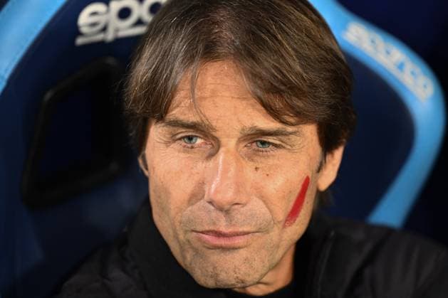 CALCIO - Serie A - SSC Napoli vs Atalanta BC Antonio Conte coach of S.S.C. Napoli particPhoto by IPA ABACAPRESS.COMtes in the 12th day of the Serie A Championship between S.S.C. Napoli and Atalanta B.C at the Diego Armando Maradona Stadium on November 22, 2025 in Naples, Italy. Naples Italy  Copyright: xIPAxSport ABACAx