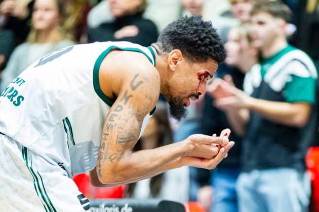 30.12.2025, xomx, Basketball easyCredit BBL Bundesliga, NINERS Chemnitz - VET-Concept Gladiators Trier v.l. Urald King (Gladiators Trier) ist schwer verletzt. Er hat einen Cut ueber dem rechten Auge, blutet stark und muss behandelt werden. Offensichtlich geht es ihm soweit gut, doch er muss die Halle dann doch verlassen. Krankenhaus? Chemnitz