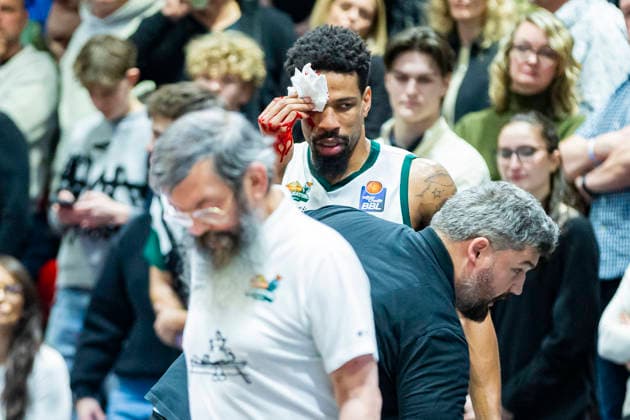 30.12.2025, xomx, Basketball easyCredit BBL Bundesliga, NINERS Chemnitz - VET-Concept Gladiators Trier v.l. Urald King (Gladiators Trier) ist schwer verletzt. Er hat einen Cut ueber dem rechten Auge, blutet stark und muss behandelt werden. Offensichtlich geht es ihm soweit gut, doch er muss die Halle dann doch verlassen. Krankenhaus? Aggy Mock Chemnitz
