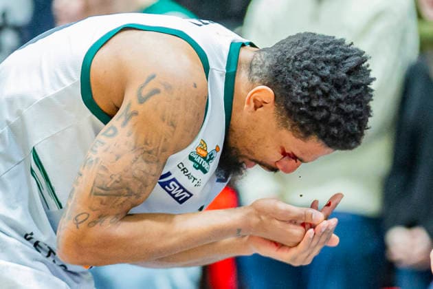 30.12.2025, xomx, Basketball easyCredit BBL Bundesliga, NINERS Chemnitz - VET-Concept Gladiators Trier v.l. Urald King (Gladiators Trier) ist schwer verletzt. Er hat einen Cut ueber dem rechten Auge, blutet stark und muss behandelt werden. Offensichtlich geht es ihm soweit gut, doch er muss die Halle dann doch verlassen. Krankenhaus? Chemnitz
