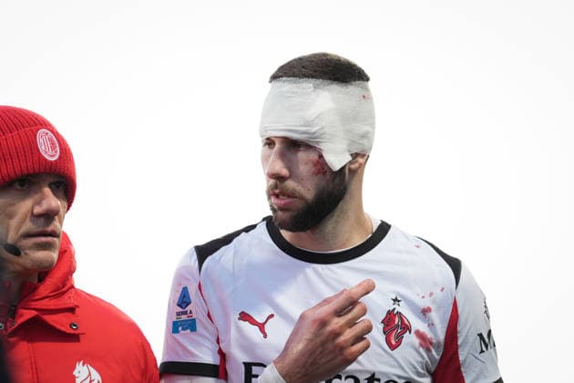 Fußball, Italien, AC Florenz - AC Mailand AC Milan s Strahinja Pavlovic leaves the field injured during the Serie A soccer match between Fiorentina and Milan at the Artemio Franchi Stadium in Florence, north Italy - Sunday, January 11, 2026 -  Copyright: xMassimoxPaolone LaPressex