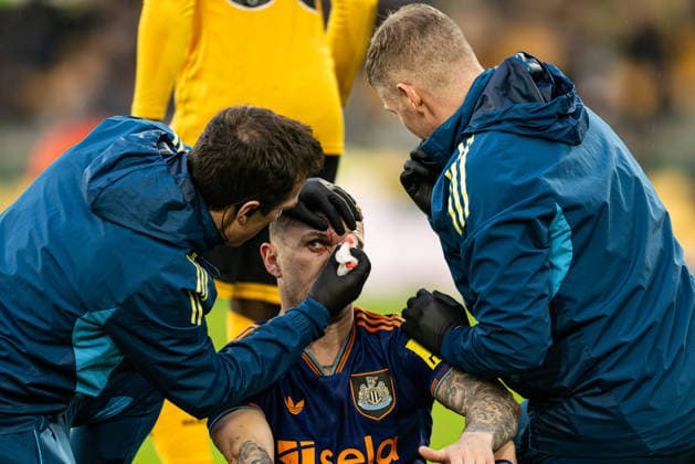 18th January 2026; Molineux Stadium, Wolverhampton, West Midlands, England; Premier League Football, Wolverhampton Wanderers versus Newcastle United; Kieran Trippier of Newcastle United receives treatment for a gash on his head following a tackle  GodfreyxPitt Content restricted for UK based newspaper