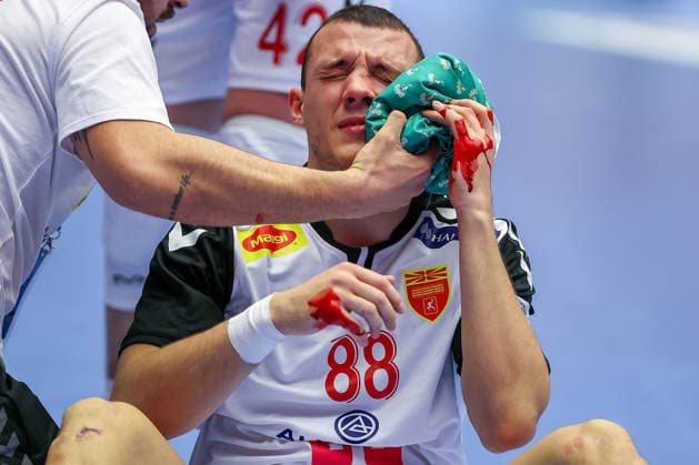 20.01.2026, Handball, Men s EHF EURO 2026, Nordmazedonien - Rumänien, Jyske Bank Boxen in Herning, Dänemark, Preliminary Round: Pavle Atanasijevikj (North Macedonia 88) sitzt blutend verletzt mit Schmerzen auf dem Spielfeld und muss medizinisch versorgt werden. Dänemark