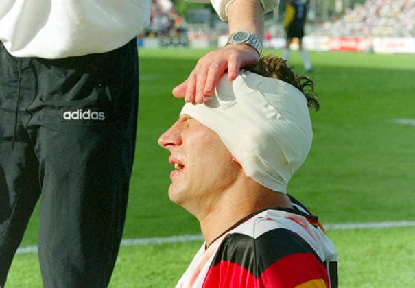 920615 Football, UEFA EURO, EM, Europameisterschaft,Fussball 1992, Group 2, Germany - Scotland 2-0: Germanys Guido Buchwald injured in the head. Photo: BILDBYRAN M027_15 scanx fotboll em em92 em 92 em 1992 em1992 tyskland skottland m027_15 bbeng dia Germany Scotland germany v scotland beng football soccer 1992 sverige sweden euro uefa euro 1992 euro1992 euro92 european championships norrkoping stadium june 15 idrottsparken *** 920615 Football, Uefa EURO 1992, Group 2, Germany Scotland 2 0 Germanys Guido Buchwald injured in the head Photo BILDBYRAN M027 15 scanx fotboll em em92 em 92 em 1992 em1992 deutschland skottland m027 15 bbeng dia Germany Scotland germany v scotland beng football soccer 1992 sverige sweden euro uefa euro 1992 euro1992 euro92 european championships norrkoping stadium june 15 idrottsparken  Copyright: BILDBYRAN BB920615BB026