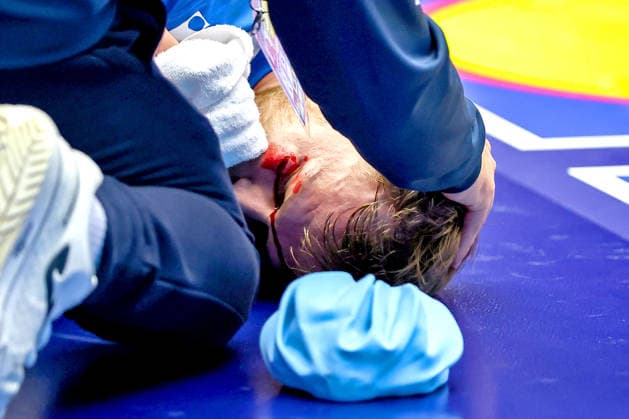01.02.2026, Handball, Men s EHF EURO 2026, Island - Kroatien, Jyske Bank Boxen in Herning, Dänemark, Placement Match 3 4: David Mandic (Croatia 39) muss mit einer Platzwunde im gesicht medizinisch versorgt werden Dänemark *** 01 02 2026, Handball, Men s EHF EURO 2026, Iceland Croatia, Jyske Bank Boxing in Herning, Denmark, Placement Match 3 4 David Mandic Croatia 39 needs medical treatment for a laceration to the face Denmark