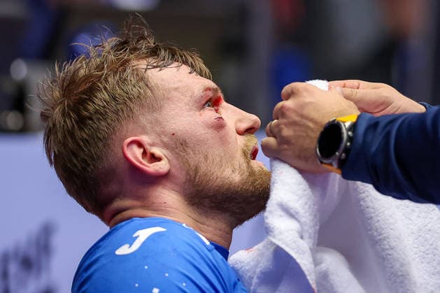 01.02.2026, Handball, Men s EHF EURO 2026, Island - Kroatien, Jyske Bank Boxen in Herning, Dänemark, Placement Match 3 4: David Mandic (Croatia 39) muss mit einer Platzwunde im gesicht medizinisch versorgt werden Dänemark