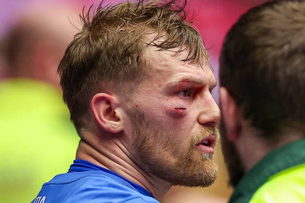01.02.2026, Handball, Men s EHF EURO 2026, Island - Kroatien, Jyske Bank Boxen in Herning, Dänemark, Placement Match 3 4: David Mandic (Croatia 39) muss mit einer Platzwunde im gesicht medizinisch versorgt werden Dänemark *** 01 02 2026, Handball, Men s EHF EURO 2026, Iceland Croatia, Jyske Bank Boxing in Herning, Denmark, Placement Match 3 4 David Mandic Croatia 39 needs medical treatment for a laceration to the face Denmark