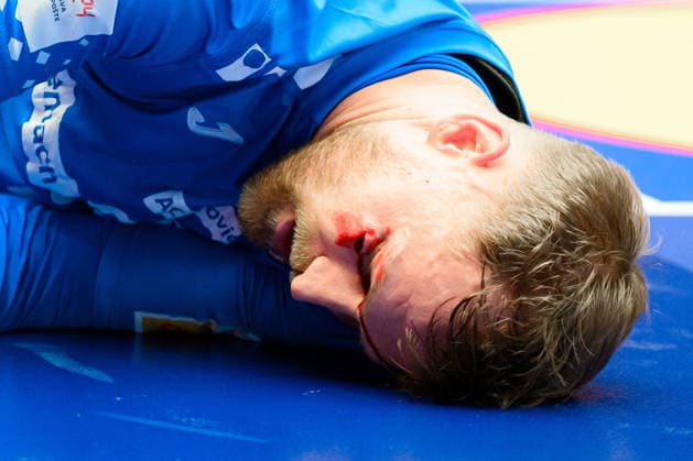 Herning: Handball EM 2026 - Spiel Platz 3 - Island - Kroatien David Mandic (Kroatien) Verletzt Verletzung Schmerzen, cut am Auge, Blut Herning Jyske Bank Boxen Daenemark