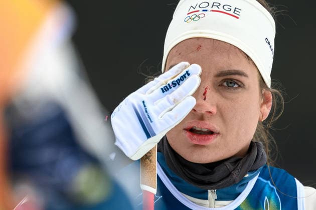 260209 Kristine Stavas Skistad of Norway at a cross-country skiing training session during day 3 of the 2026 Winter Olympics on February 9, 2026 in Val di Fiemme. Photo: Maxim Thore BILDBYRAN kod MT MT0966 skidor cross-country skiing langrenn Olympic Games, Olympische Spiele, Olympia, OS olympics winter olympics os ol olympiska spel vinter-os olympiske leker milano cortina 2026 milan cortina 2026 milano cortina 2026 olympic games milano cortina 2026 winter olympic games milano cortina-os milano cortina-ol vinter-ol 3 bbeng träning norge skada *** 260209 Kristine Stavas Skistad of Norway at a cross country skiing training session during day 3 of the 2026 Winter Olympics on February 9, 2026 in Val di Fiemme Photo Maxim Thore BILDBYRAN kod MT MT0966 skidor cross country skiing langrenn olympic games olympics winter olympics os ol olympiska spel vinter os olympiske leker milano cortina 2026 milan cortina 2026 milano cortina 2026 olympic games milano cortina 2026 winter olympic games milano cortina os milano cortina ol vinter ol 3 bbeng träning norge skada  Copyright: MAXIMxTHORE BB260209MT014