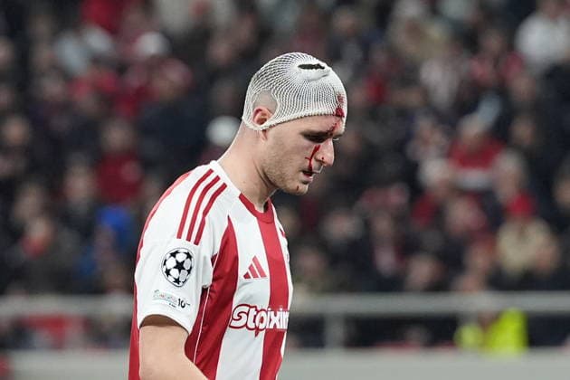 UEFA Champions League - Olympiacos FC vs Bayer 04 Leverkusen - Lorenzo Pirola of Olympiacos FC react injuredduring the UEFA Champions League Play-Offs 1st leg soccer match between Olympiacos FC and Bayer 04 Leverkusen in Georgios Karaiskakis Stadium, Piraeus, Greece, on 18 February 2026. IMAGO ONE INCH PRODUCTIONS PIRAEUS GREECE Copyright: xONExINCHxPRODUCTIONSx 6859950
