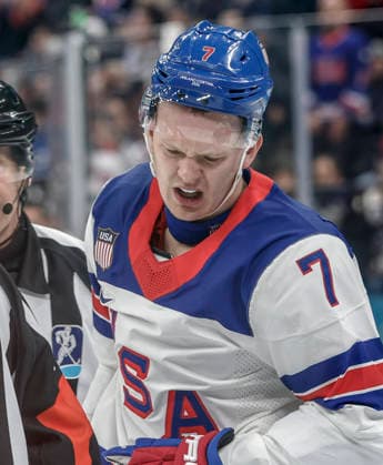 United States Brady Tkachuk (7) reacts after taking a punch from Slovakia s Martin Fehervary (42) in the second period of the Men s Hockey Play-off Semifinal game between Slovakia and the USA at the Milano Santagiulia Ice hockey, Eishockey Arena in Milan, Italy, on Friday, February 20, 2026.  OLY20260220321 AARONxJOSEFCZYK