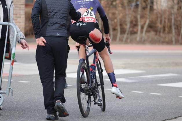 Fenix - Ekoï Omloop van het Hageland AARSCHOT TIELT - WINGE, Belgium 01 03 2026 Rondel Lea (FRA) of Mayenne Monbana My Pie injury Pictured during the Fenix - Ekoï Omloop van het Hageland on 01 March 2026 ( Picture by Gianni Barbieux Photo News ). Gent Belgium  Copyright: xGiannixBarbieuxx